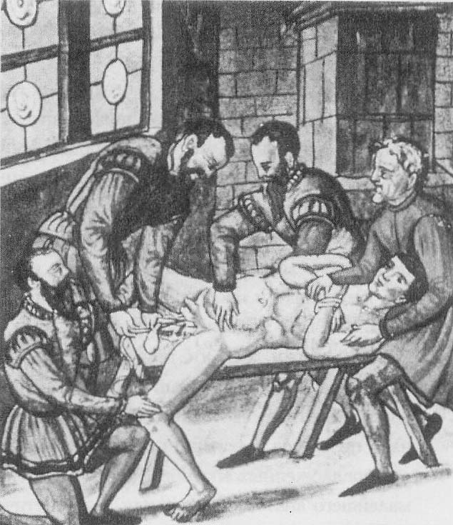 хирургическое лечение паховой грыжи в средние века